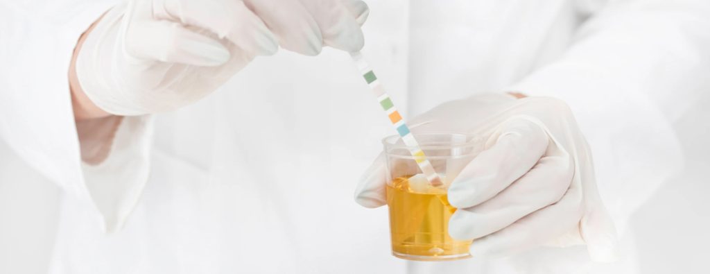 The Remarkable Benefits of Synthetic Urine Kits